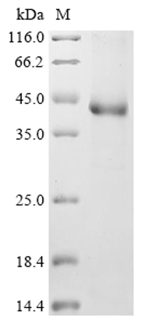 (Tris-Glycine gel) Discontinuous SDS-PAGE (reduced) with 5% enrichment gel and 15% separation gel.