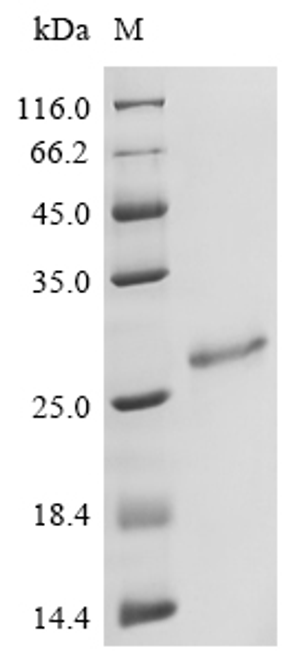 (Tris-Glycine gel) Discontinuous SDS-PAGE (reduced) with 5% enrichment gel and 15% separation gel.