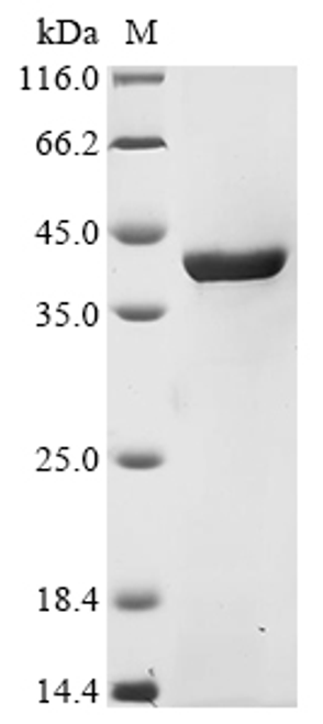 (Tris-Glycine gel) Discontinuous SDS-PAGE (reduced) with 5% enrichment gel and 15% separation gel.