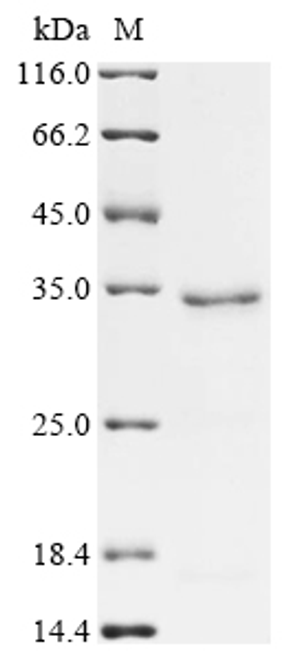 (Tris-Glycine gel) Discontinuous SDS-PAGE (reduced) with 5% enrichment gel and 15% separation gel.