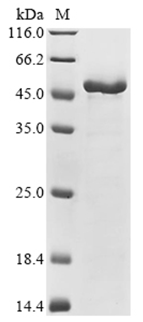 (Tris-Glycine gel) Discontinuous SDS-PAGE (reduced) with 5% enrichment gel and 15% separation gel.