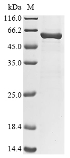 (Tris-Glycine gel) Discontinuous SDS-PAGE (reduced) with 5% enrichment gel and 15% separation gel.