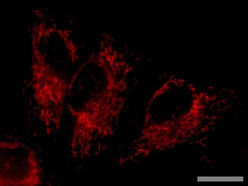 pMitophagy Keima-Red mPark2 (Hyg) pMitophagy Keima-Red mPark2 (Hyg)