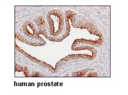 Anti-SLC2A13 (HMIT) (Human) pAb Anti-SLC2A13 (HMIT) (Human) pAb