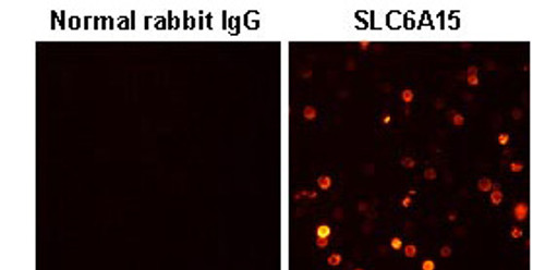 Anti-SLC6A15 (SBAT1) (Human) pAb Anti-SLC6A15 (SBAT1) (Human) pAb