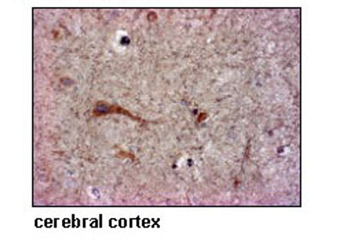 Anti-SLC6A15 (SBAT1) (Human) pAb Anti-SLC6A15 (SBAT1) (Human) pAb
