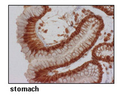 Anti-SLC6A14 (ATB0+) (Human) pAb Anti-SLC6A14 (ATB0+) (Human) pAb