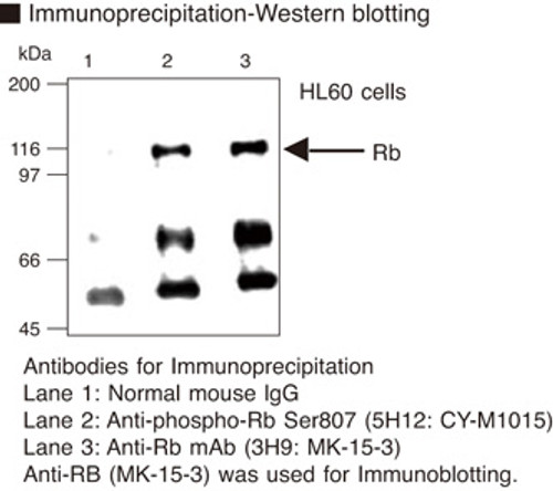 Anti-Phospho-Rb (Ser807) mAb (Clone: 5H12) Anti-Phospho-Rb (Ser807) mAb (Clone: 5H12)