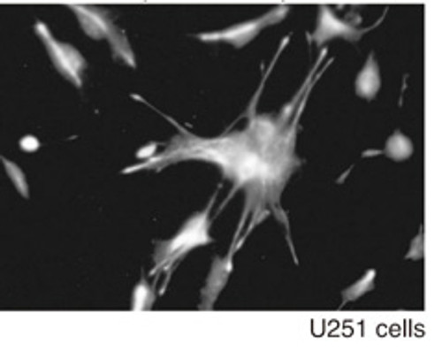 Anti-Phosphorylated Vimentin (Ser82) (Clone: MO82)