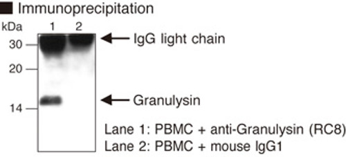Anti-Granulysin (Human) mAb (Clone: RC8) Anti-Granulysin (Human) mAb (Clone: RC8)