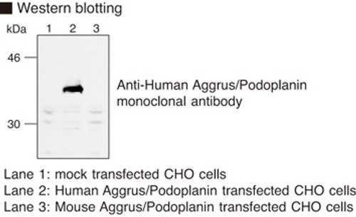 Anti-Aggrus (Podoplanin) (Human) mAb (Clone: YM-1) Anti-Aggrus (Podoplanin) (Human) mAb (Clone: YM-1)