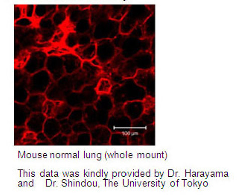 Anti-Aggrus (Podoplanin) (Mouse) mAb (Clone: 8F11) Anti-Aggrus (Podoplanin) (Mouse) mAb (Clone: 8F11)