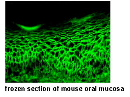 Anti-Desmoglein 3 (Mouse) mAb (No Azide) (Clone: AK18) Anti-Desmoglein 3 (Mouse) mAb (No Azide) (Clone: AK18)