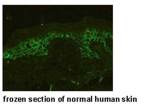 Anti-Desmoglein 3 (Mouse) mAb (No Azide) (Clone: AK23) Anti-Desmoglein 3 (Mouse) mAb (No Azide) (Clone: AK23)