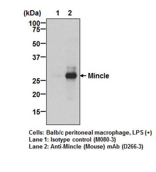 Anti-Mincle (Mouse) mAb (Clone: 1B6) Anti-Mincle (Mouse) mAb (Clone: 1B6)