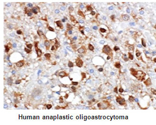 Anti-IDH1-R132S (Human) mAb (Clone: SMab-1) Anti-IDH1-R132S (Human) mAb (Clone: SMab-1)