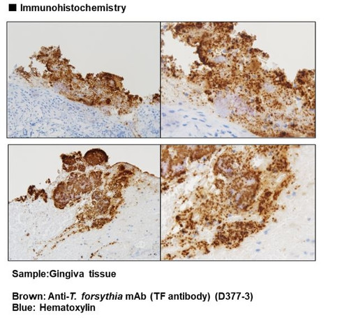 Anti-T. forsythia mAb (TF antibody) (Clone: CH1-9) Anti-T. forsythia mAb (TF antibody) (Clone: CH1-9)