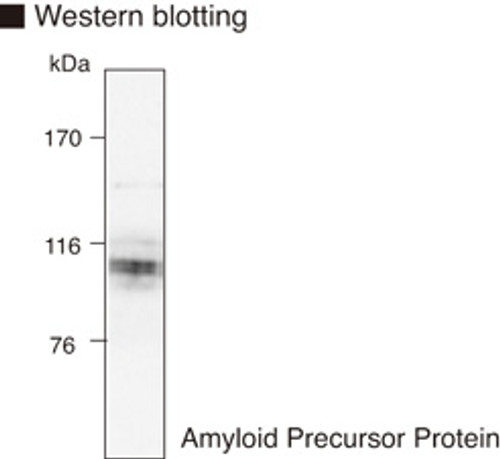 Anti-Amyloid Precursor Protein (Human/Mouse) mAb (Clone: 3E9) Anti-Amyloid Precursor Protein (Human/Mouse) mAb (Clone: 3E9)