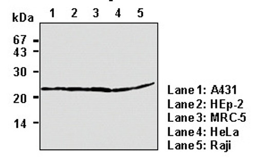 Anti-BAX (Human) mAb (Clone: 4F11) Anti-BAX (Human) mAb (Clone: 4F11)