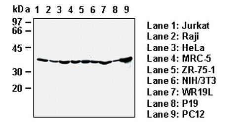 Anti-Hsp40 (Human) mAb (Clone: 2E1) Anti-Hsp40 (Human) mAb (Clone: 2E1)