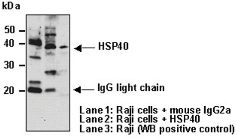 Anti-Hsp40 (Human) mAb (Clone: 2E1) Anti-Hsp40 (Human) mAb (Clone: 2E1)