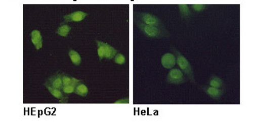 Anti-RCC1 (Human) mAb (Clone: 3D11) Anti-RCC1 (Human) mAb (Clone: 3D11)