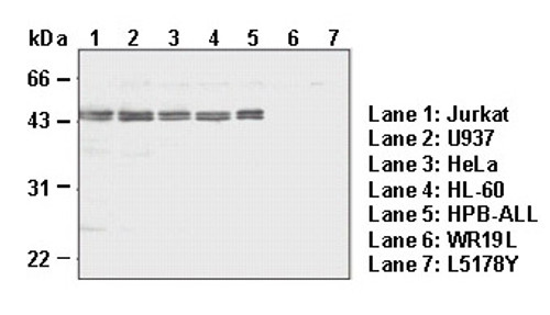 Anti-Caspase-8 (Human) mAb (Clone: 5D3) Anti-Caspase-8 (Human) mAb (Clone: 5D3)
