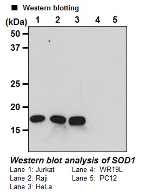 Anti-SOD1 (Human) mAb (Clone: 1G2) Anti-SOD1 (Human) mAb (Clone: 1G2)