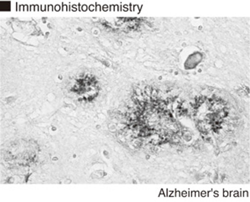 Anti-Apolipoprotein E4 (Human) mAb (Clone: 1F9) Anti-Apolipoprotein E4 (Human) mAb (Clone: 1F9)
