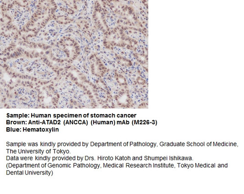Anti-ATAD2 (ANCCA) (Human) mAb (Clone: C20-19) Anti-ATAD2 (ANCCA) (Human) mAb (Clone: C20-19)