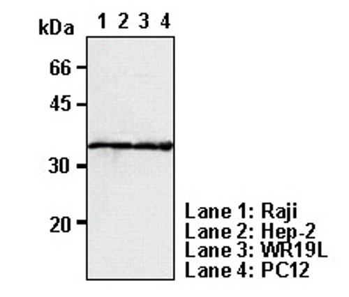 Anti-PCNA (ProlifeRating Cell Nuclear Antigen) (Rat) mAb (Clone: 5A10) Anti-PCNA (ProlifeRating Cell Nuclear Antigen) (Rat) mAb (Clone: 5A10)