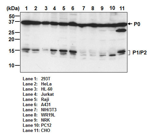 Anti-Ribosomal P0/P1/P2 mAb (Clone: 9D5)