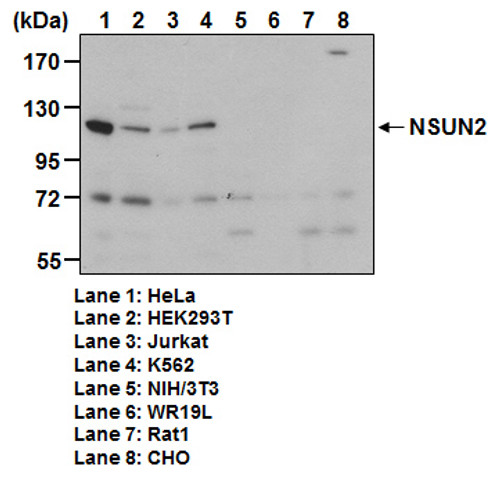 Anti-NSUN2 (Human) pAb Anti-NSUN2 (Human) pAb