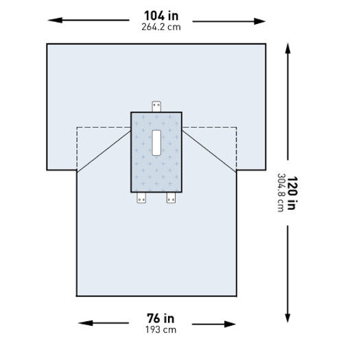 Abdominal Drape McKesson Laparotomy Drape 104 W X 76 W X 120 L Inch Sterile (PK)