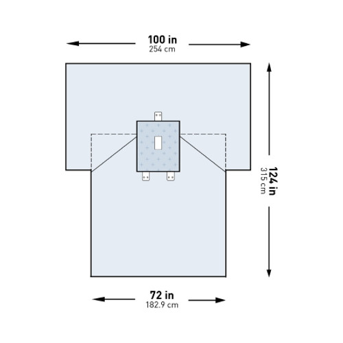 Abdominal Drape McKesson Pediatric Laparotomy Drape 100 W X 72 W X 124 L Inch Sterile (CS)