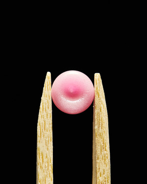 MTP Anus Pearl MTP Anus Pearl