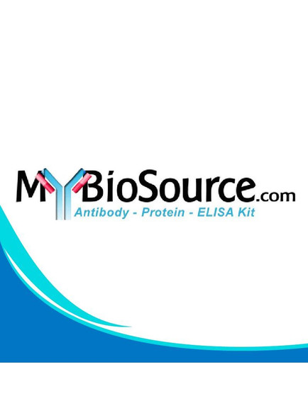 Chicken Immunoglobulin E ELISA Kit