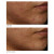 Dr. Dennis Gross Skincare DRx SpectraLite??FaceWare Pro