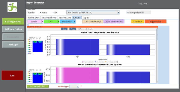 Suppression Map Software for LENSware3™