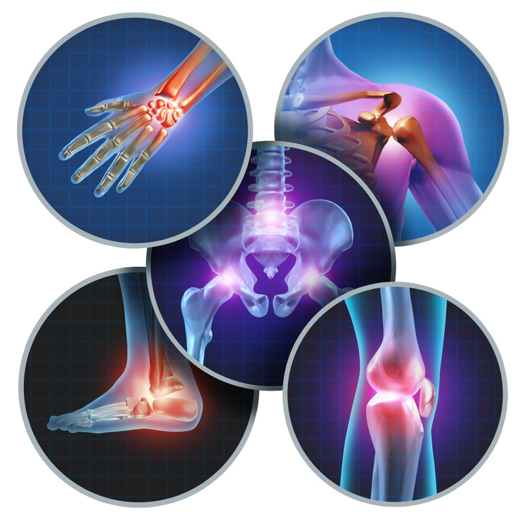 Four Ways To Improve Joint Health