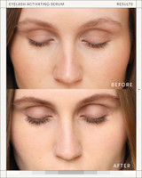 M2 Beaute Eyelash Activating Serum
