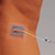 Stayfix Catheter Fixation Device