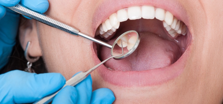 Dental patient with mouth open with dentist assessing inside mouth