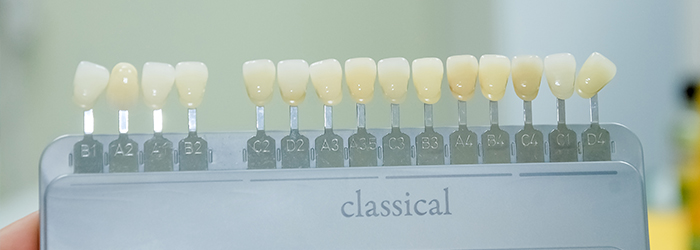 are-dental-implants-right-for-you