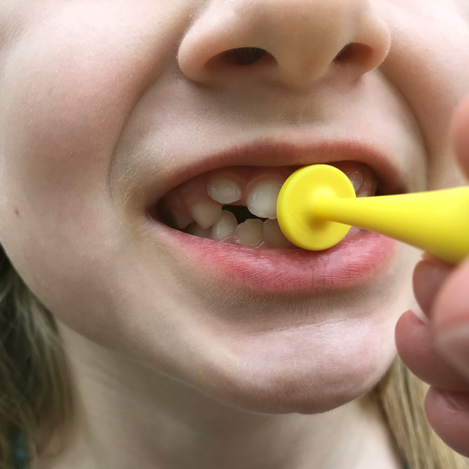 ARK's Button Tips for Lip Closure | Z-Vibe Tips | ARK Therapeutic