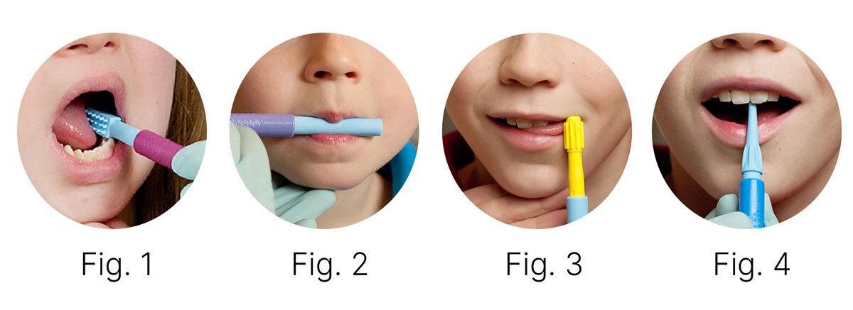 Illustrated examples of five Z-Vibe therapy exercises: Oral Awareness, Lip Closure, Tongue Lateralization, Tongue Elevation, and Jaw Strength