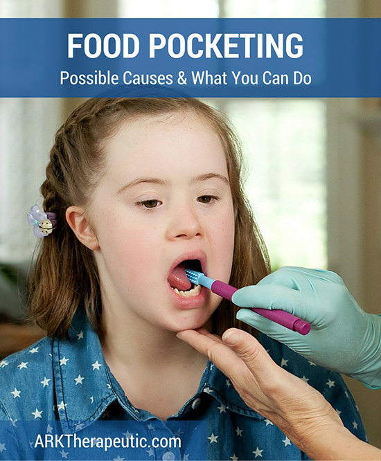 Food Pocketing in the Lips, Cheeks, and/or Gums ARK Products, LLC