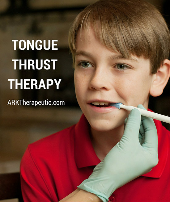 Tongue Thrust Therapy ARK Products, LLC