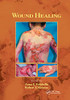 Wound Healing (Basic and Clinical Dermatology)