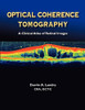 Optical Coherence Tomography: A Clinical Atlas of Retinal Images